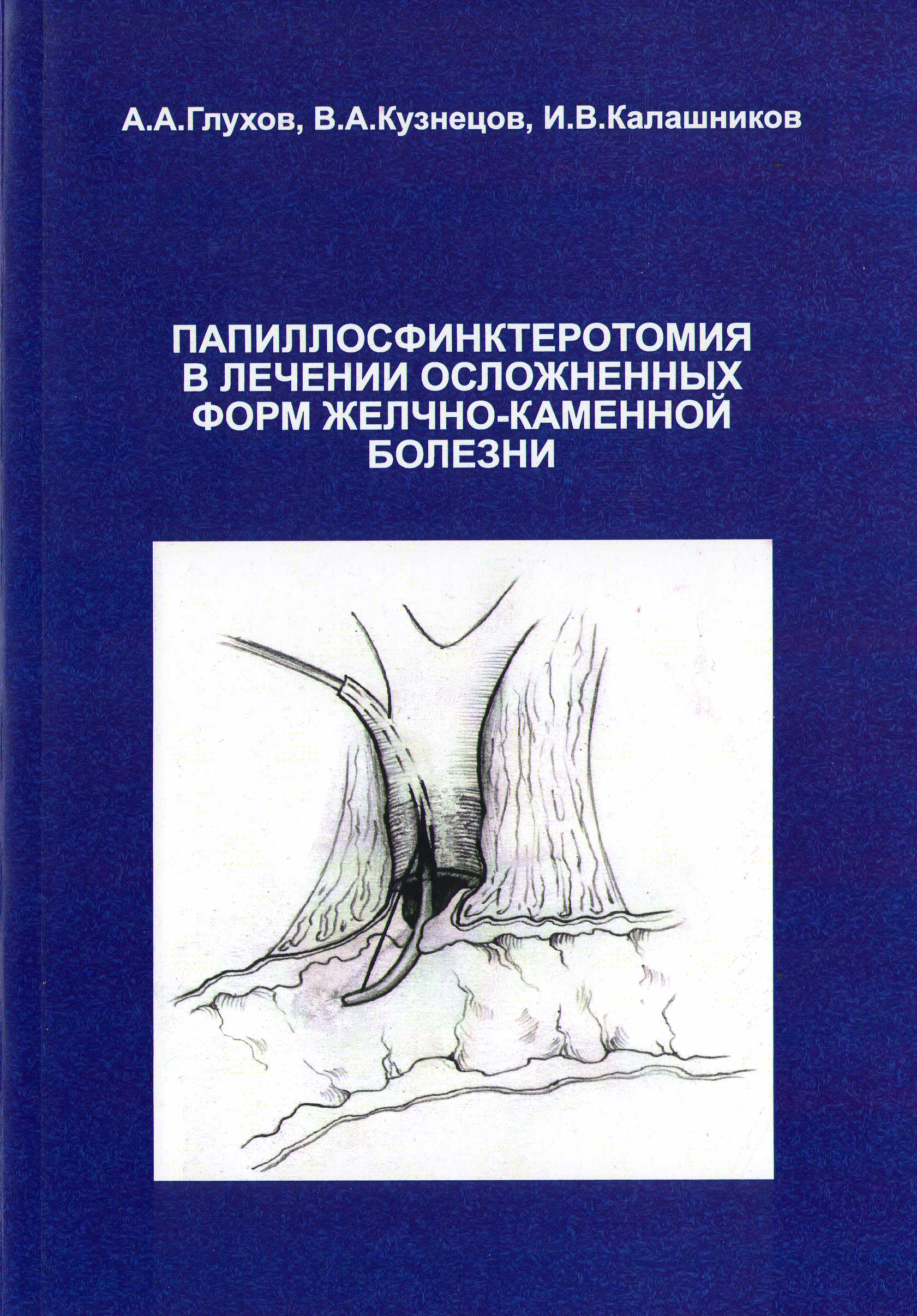 Папилосфинктеротомия